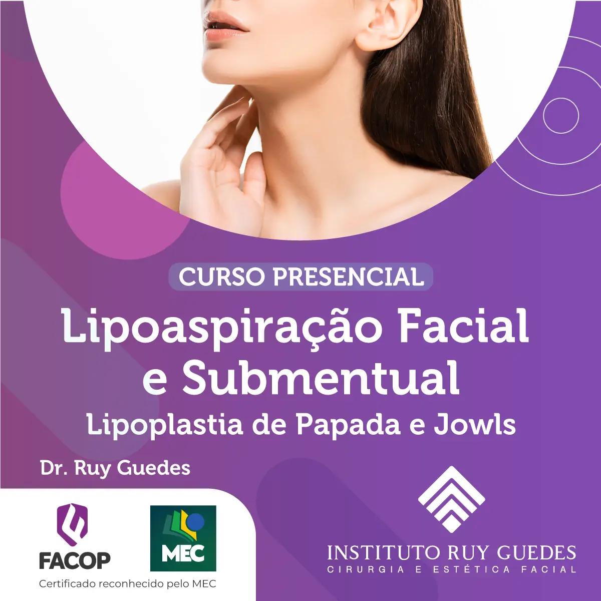Curso Presencial de Lipoaspiração Facial e Submentual - Lipoplastia de Papada e Jowls